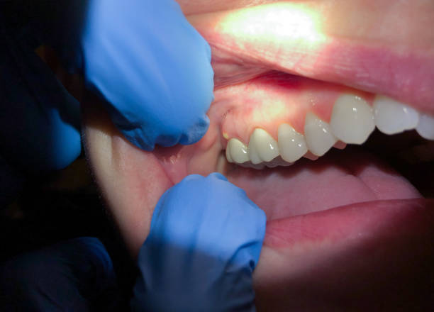 Best Tooth Infection Emergency Dentist  in East Pittsburgh, PA